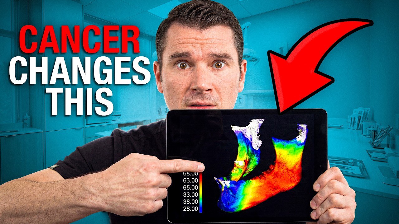 Dental Implants and Cancer: Why Timing Is Everything!