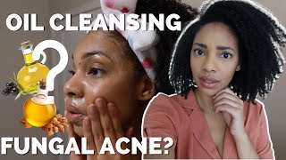 OIL CLEANSING GUIDE FOR FUNGAL ACNE Malassezia oil cleansing method w squalane oil vs mct oil