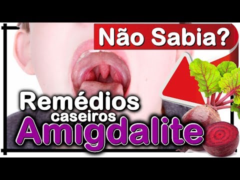 Vídeo: 5 Remédios Caseiros Para Amigdalite: Tratamento E Alívio