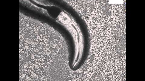 Spitting by the C. elegans roundworm