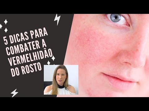 Vídeo: Como curar a vermelhidão no rosto durante a noite?