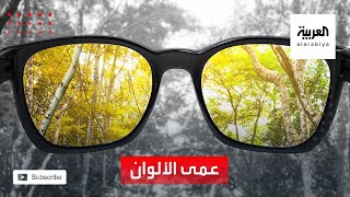 صحتك+ | الإصابة بعمى الألوان سببه الرئيسي هو العامل الوراثي