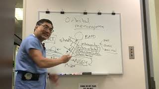 Orbital Meningioma