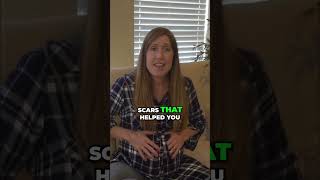 Embrace Your Stretch Marks: Pregnancy's Beautiful Battle Scars #shorts