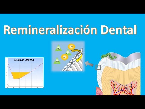 Video: ¿Funciona la remineralización dental?