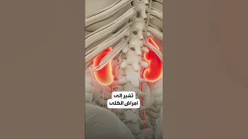 خمس علامات في قدميك تشير إلى حالة كليتيك 