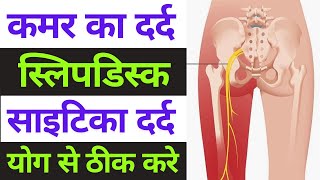 योग से साइटिका दर्द कमर दर्द ठीक करे। yoga for back pain & sciatica 