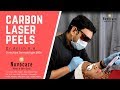 Carbon Laser Peels - Novocare Skin Clinic Kochi