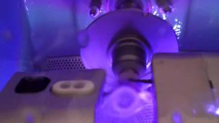 Cerec Dental Crown Restoration