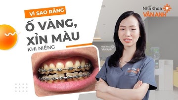 Vì sao răng ố vàng, xỉn màu khi niềng | Nha Khoa Vân Anh #niengrang