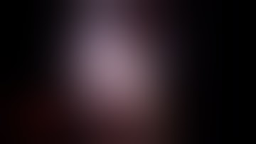 Laparoscopic cholecystectomy (keyhole surgery) - for multiple gallbladder stones by Dr Hitesh Chavda