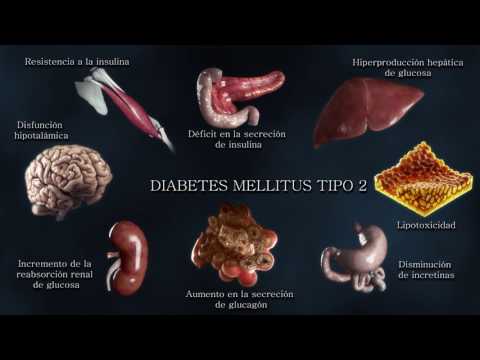 Etiopatogenia de la Diabetes tipo2: de la triada clásica al Octeto Ominoso