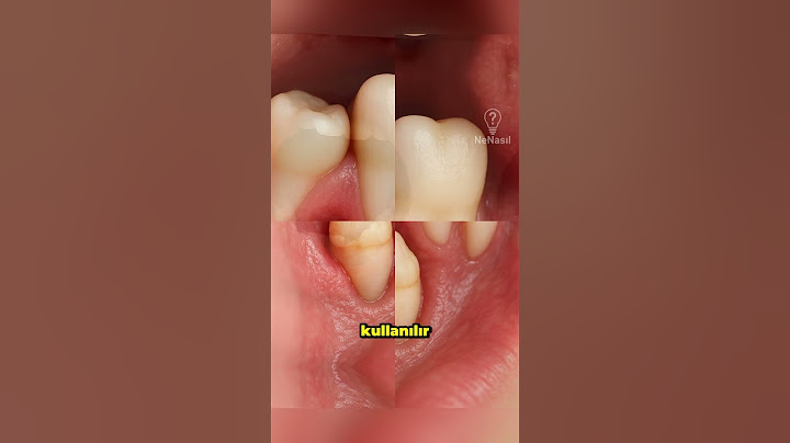 Süt Dişleri Yenilenir, Peki Yetişkin Dişleri Neden Çıkmaz?