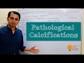 Pathologic Calcification: Dystrophic and Metastatic Calcification || Calcification Pathophysiology