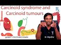 Carcinoid Syndrome & Carcinoid Tumors Explained | Dr. Digvijay | NEET-PG/NEXT/FMGE/USMLE