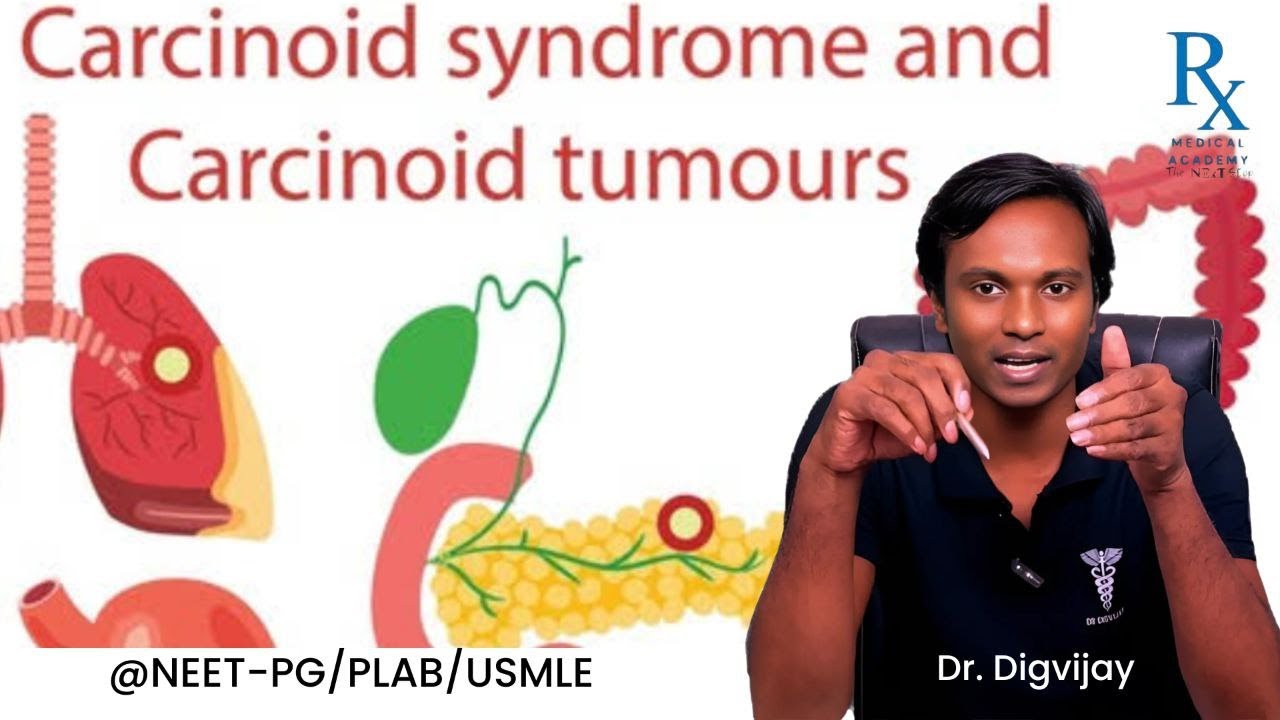 Carcinoid Syndrome & Carcinoid Tumors Explained | Dr. Digvijay | NEET ...