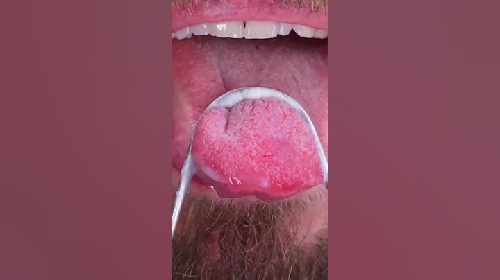 Do you remember to clean your tongue with a scraper? 😱🙈 #shorts