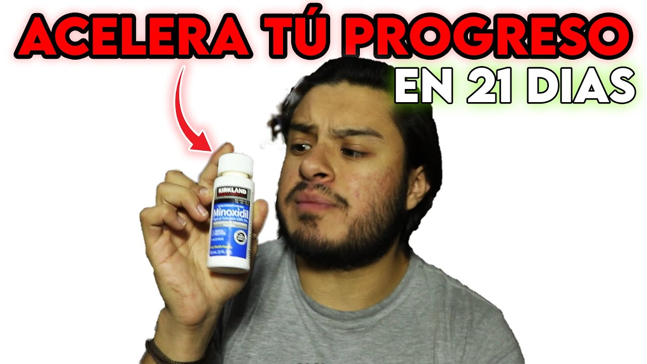 COMO ACELERAR EL CRECIMIENTO DE TU BARBA CON ESTE  SECRETO  TEN MAS BARBA CON MINOXIDIL 5% KIRLAND