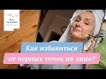 Как избавиться от черных точек на лице?