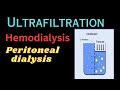 How ultrafiltration occurs in  dialysis  what is ufr ultrafiltration rate