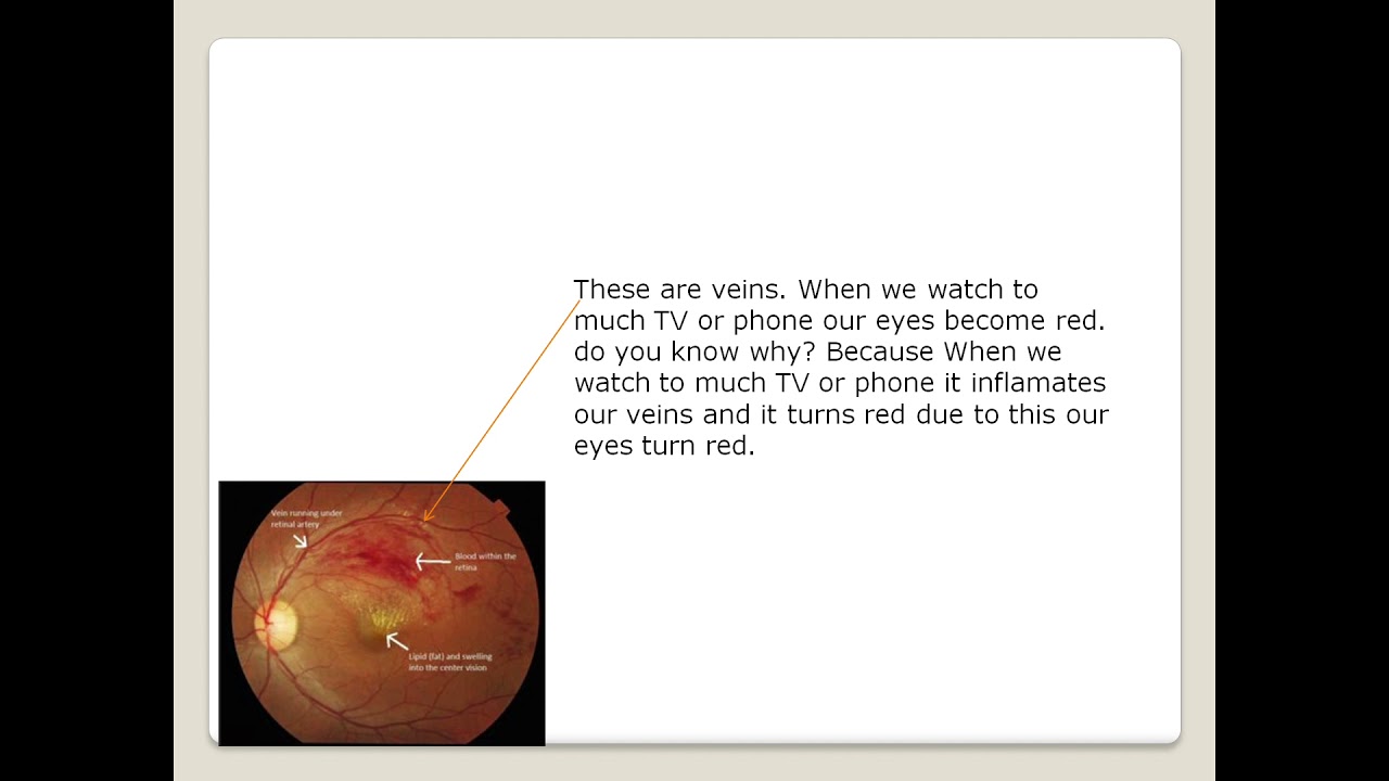 About the eye  YouTube