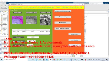 Histopathological Oral Squamous Cell Carcinoma (OSCC) image classification matlab code