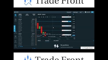 How I Mitigate Losses Trading Nadex Binary Options (YT Shorts)
