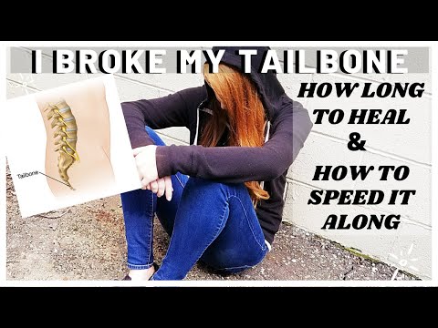 HOW LONG WILL THE PAIN LAST FROM A BROKEN TAILBONE | I FELL DOWN THE STAIRS AND INJURED MY TAILBONE