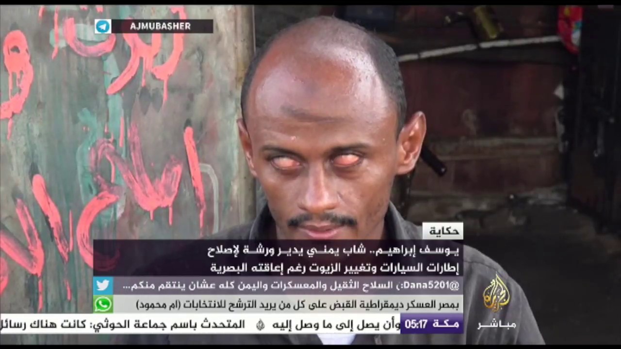 يمني كفيف يدير ورشة لإصلاح إطارات السيارات وتغيير الزيوت