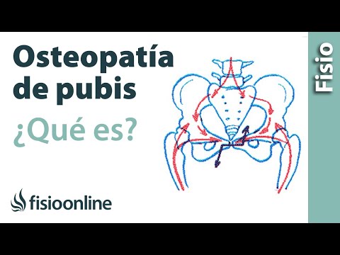 Video: ¿Por qué se revienta mi sínfisis púbica?