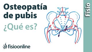 Pubalgia u osteopatía de pubis - Qué es, causas, síntomas y tratamiento