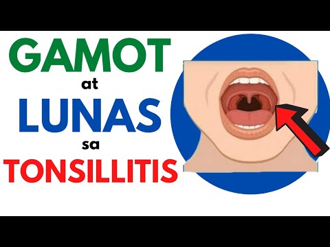 LUNAS at GAMOT sa TONSILLITIS | Masakit LUMUNOK, Namamagang TONSILS sa Bata at Matanda