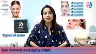 Types Of Acne/ Cause of Acne/ Dr. Seema Sitaula/ Face Forward Anti Aging Clinic