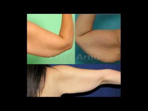 exercises for flabby arms