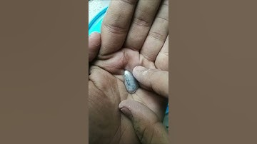 Why is mercury used in thermometers?