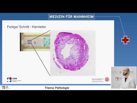 Video: Wofür verwenden Ärzte Mikroskope?