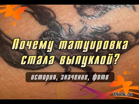 Почему татуировка стаёт выпуклой?