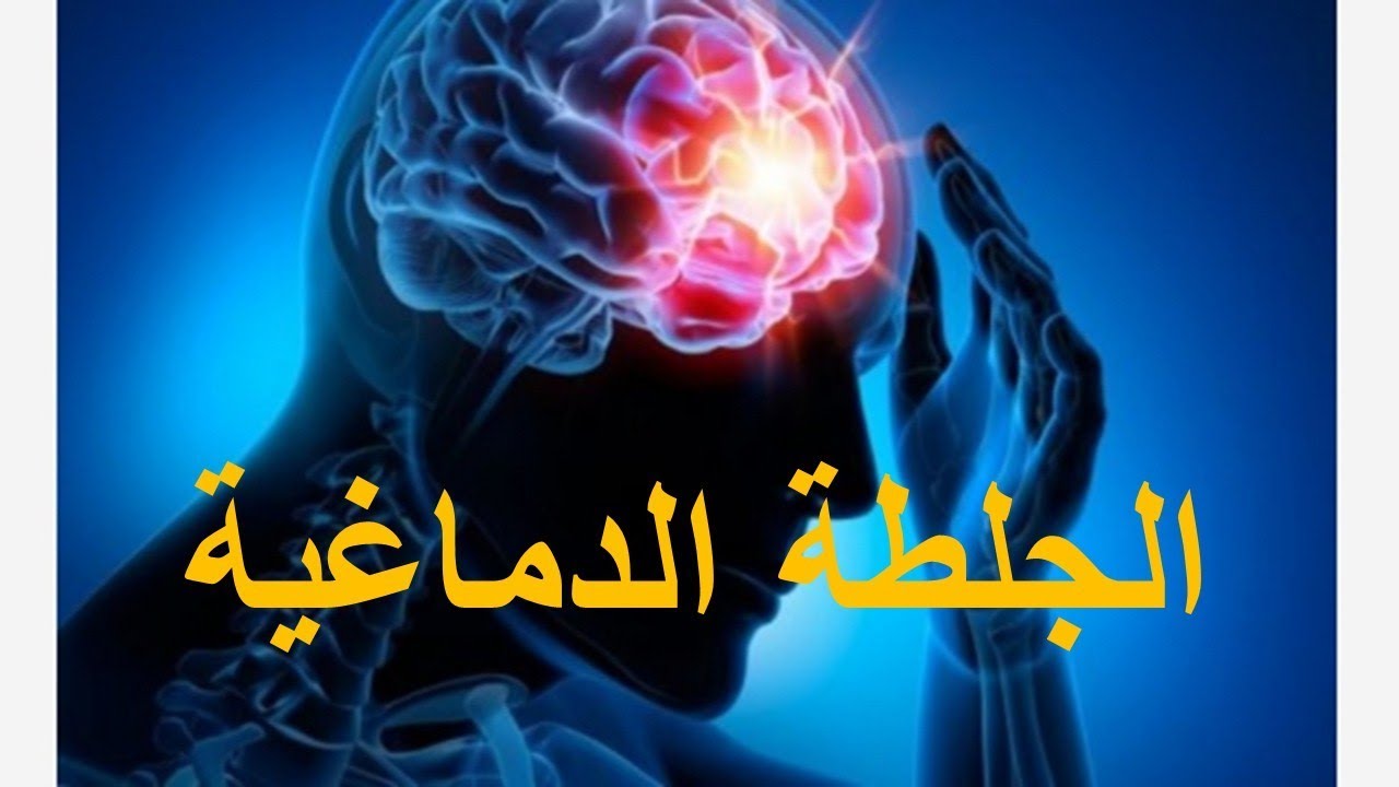 كل ما يجب معرفته عن الجلطة الدماغية.. AVC