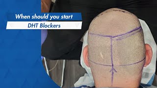When Should You Start DHT Blockers?