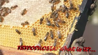 Trypophobia What Is It? World Facts