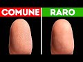 Come vivono e viaggiano le persone senza impronte digitali