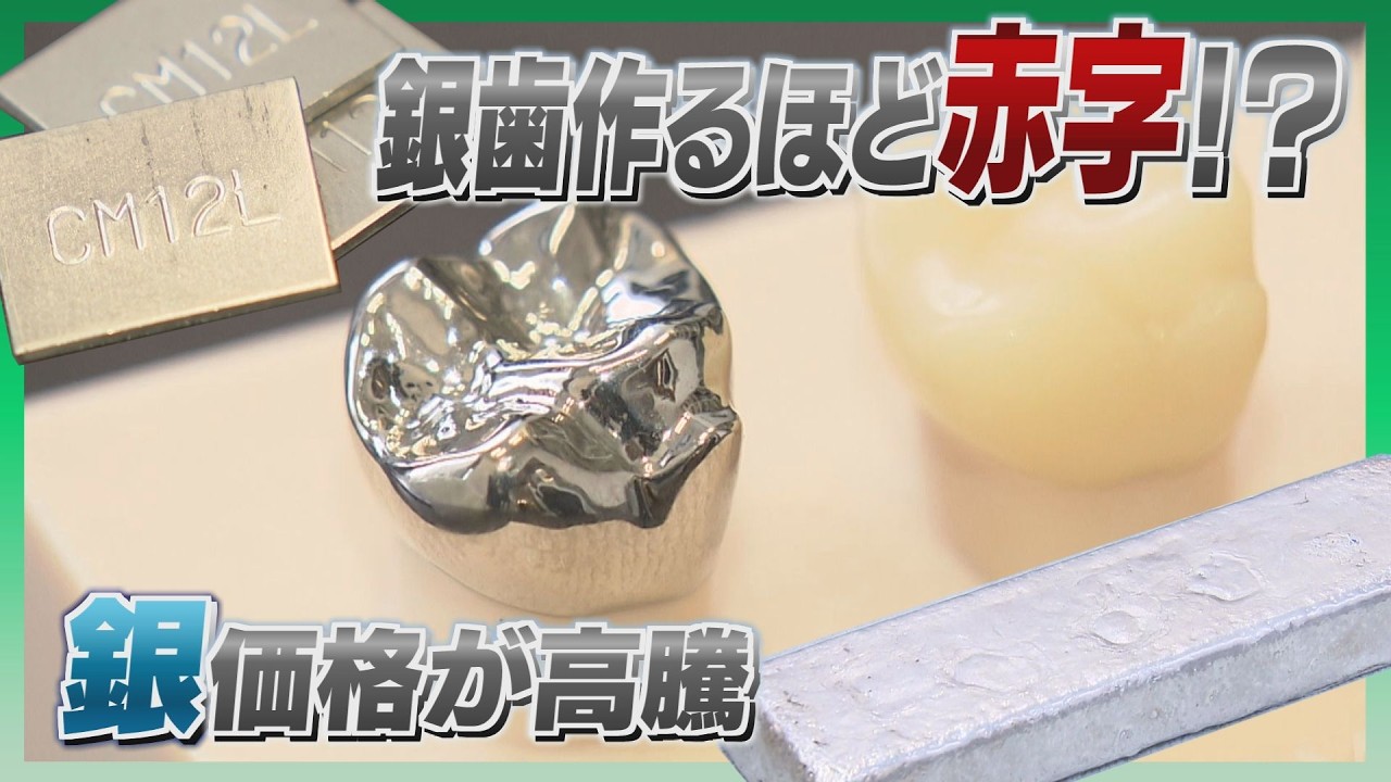 Silver prices have quadrupled in three years, causing dental