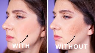 Simple Powder Trick For Pitted Acne Scars