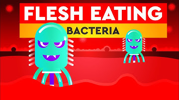 Flesh Eating Bacteria (Necrotizing fasciitis)