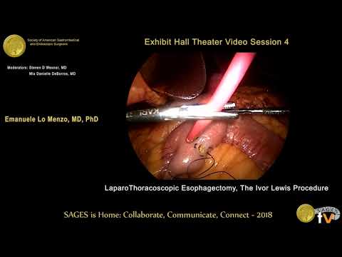 Video: Atklātā Esophagectomy: Mērķis, Procedūra Un Riski