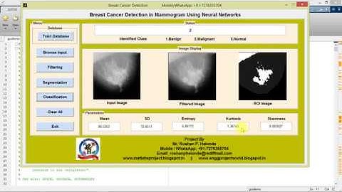 Breast Cancer Detection using Neural Network matlab project code