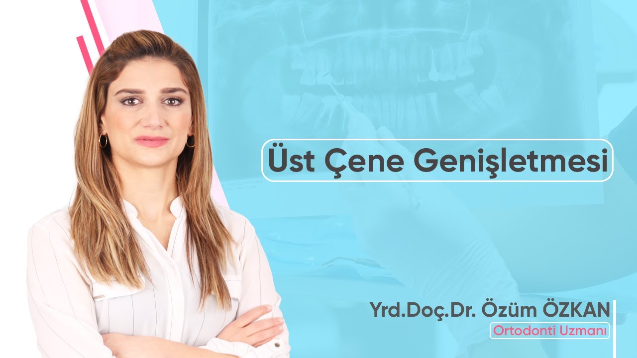 Üst Çene Darlığı ve Üst Çene Genişletme Tedavisi