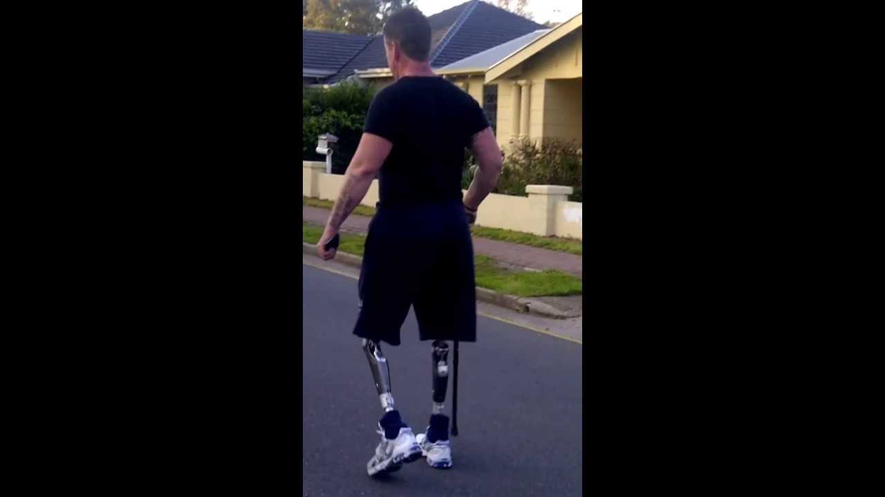 bilateral above knee amputee Darren walking with c-legs - YouTube