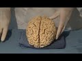 Cortical Localization: Neuroanatomy Video Lab - Brain Dissections