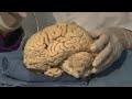 Cortical Localization: Neuroanatomy Video Lab - Brain Dissections